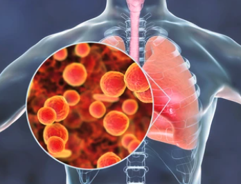 Enhanced Sterile Liquid Filtration through Mycoplasma Control